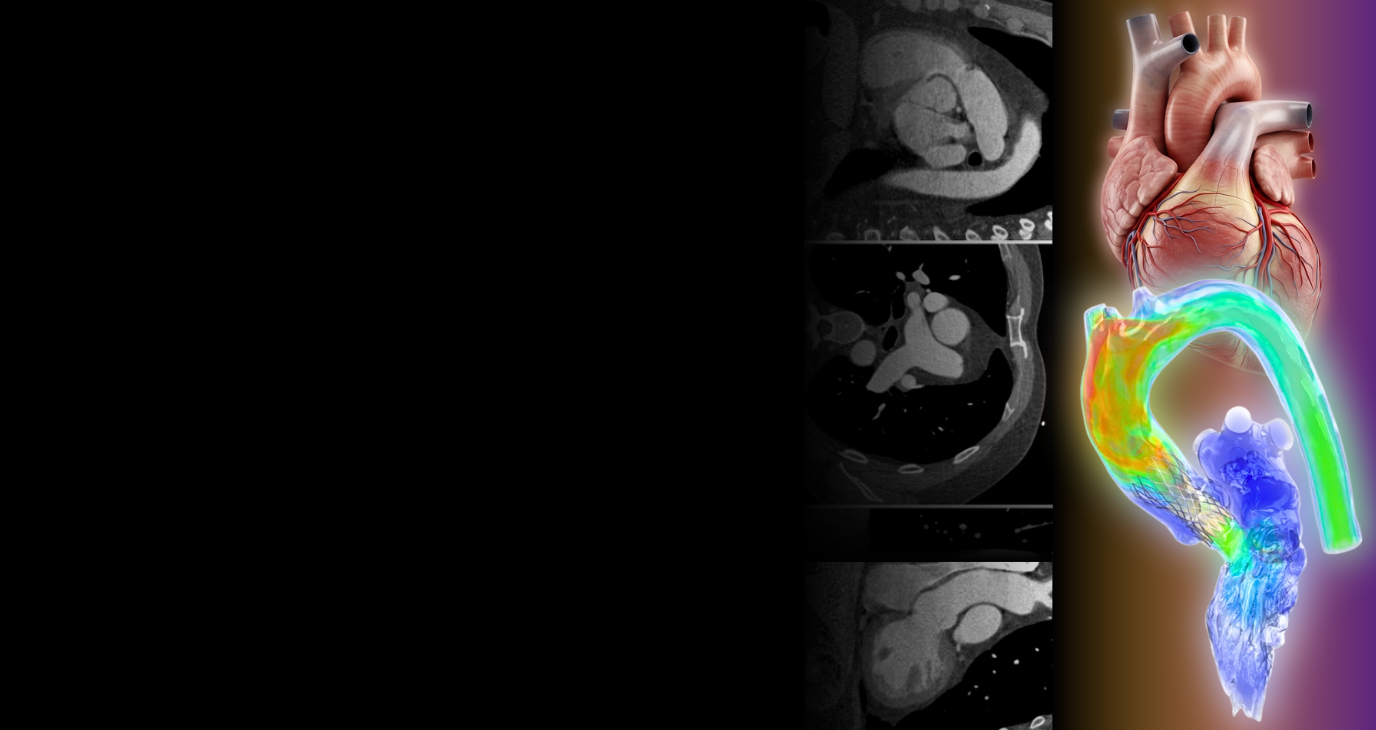 from-your-heart-to-patient-specific-simulation-in-twenty-minutes-an-ai-driven-synopsys-and-ansys-workflow-banner.png